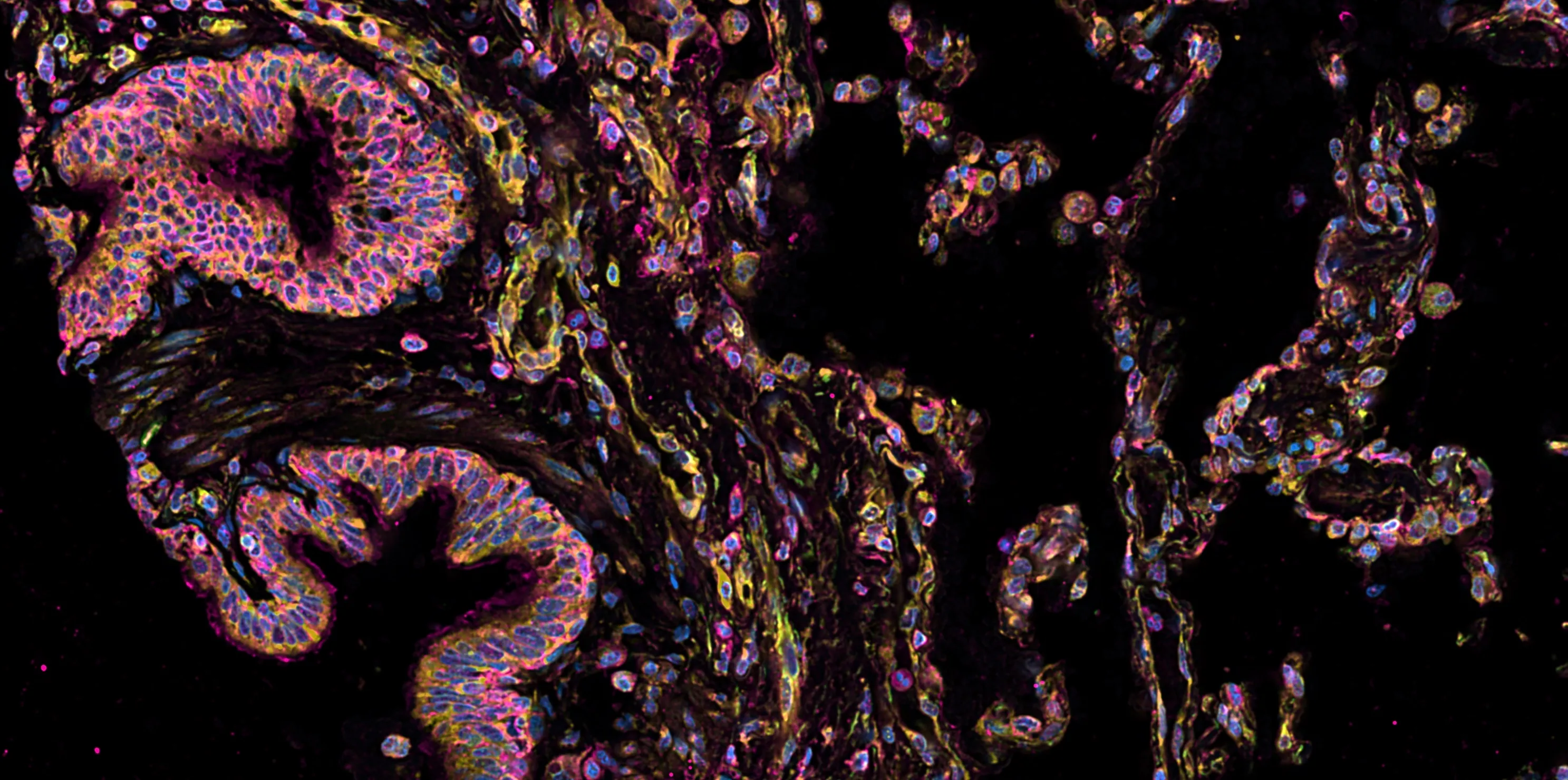 Xenium spatial transcriptomics image of tissue showing multiplexed cellular markers